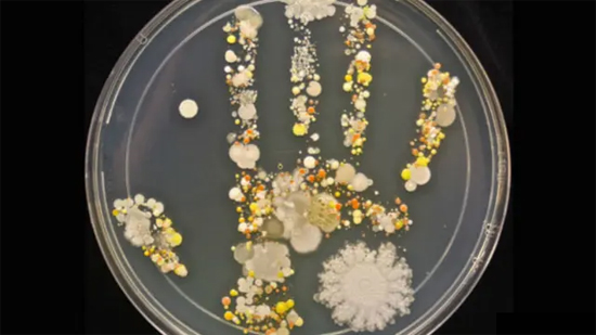 Placa de Petri com colônias de bactérias e fungos crescendo no formato de uma mão, mostrando a diversidade de micro-organismos presentes na pele humana.